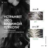 Виши Деркос Интенсивный шампунь против перхоти, зуда и себореи для нормальных и жирных волос с селеном и салициловой кислотой 75мл №3